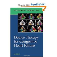 Device Therapy for Congestive Heart Failure
