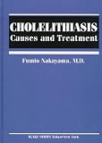 Cholelithiasis: Causes and Treatment