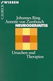 Neurodermitis: Ursachen und Therapien