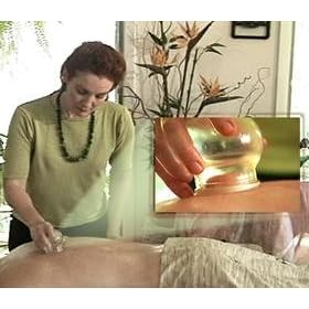 Massage Cupping Video - DVD