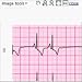 ECG pocket for PalmOS