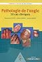 Pathologie de l'ongle : 50 cas cliniques