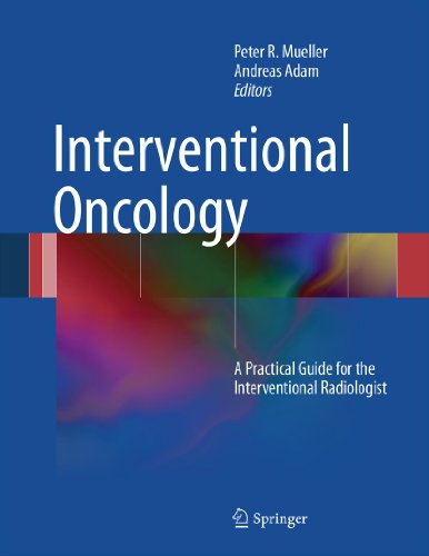 Interventional Oncology: A Practical Guide for the Interventional Radiologist