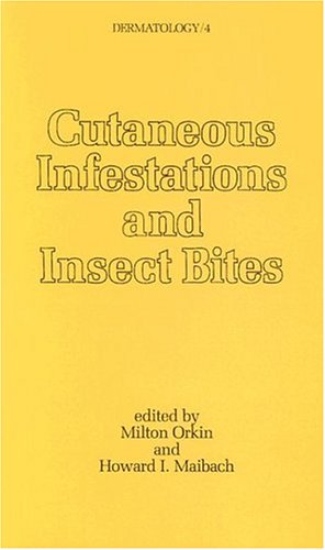 Insect-Bites-and-Stings