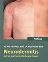 Neurodermitis. Juckreiz und Hautentz&uuml;ndungen stoppen