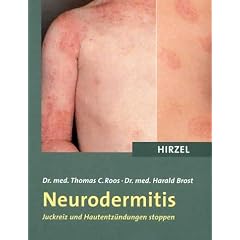 Neurodermitis. Juckreiz und Hautentz�ndungen stoppen