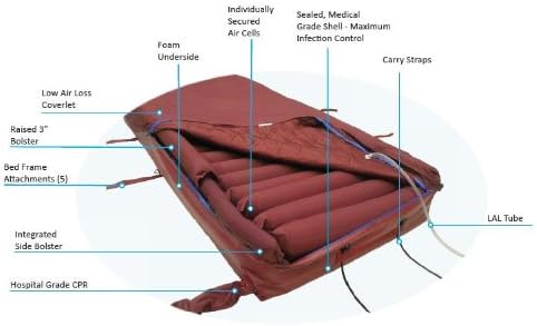 ST 1400 Mattress System - Uses Micro-ventTM Technology