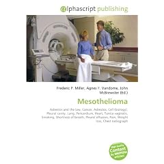 Mesothelioma: Asbestos and the law, Cancer, Asbestos, Cell (biology), Pleural cavity, Lung, Pericardium, Heart, Tunica vaginalis, Smoking, Shortness ... effusion, Pain, Weight loss, Chest radiograph