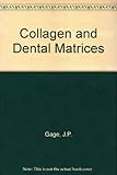 Collagen and dental matrices