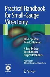 Practical Handbook for Small-Gauge Vitrectomy: A Step-By-Step Introduction to Surgical Techniques