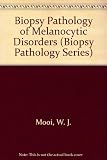 Biopsy pathology of melanocytic disorders