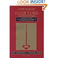How to Beat Hair Loss: The Complete Guide to Surgical, Medical, and Alternative Treatments for Hair Loss by Antonio Alvi Armani