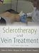 Sclerotherapy and Vein Treatment, Second Edition S