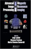  : Advanced Image Processing in Magnetic Resonance Imaging (Signal Processing and Communications)