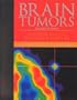Brain Tumors: An Encyclopedic Approach, 2e