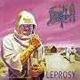 Leprosy