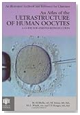 An Atlas of the Ultrastructure of Human Oocytes: A Guide for Assisted Reproduction (Encyclopedia of Visual Medicine Series)