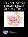 American Cancer Society Atlas of Clinical Oncology: Cancer of the Female Lower Genital Tract (Book with CD-ROM)