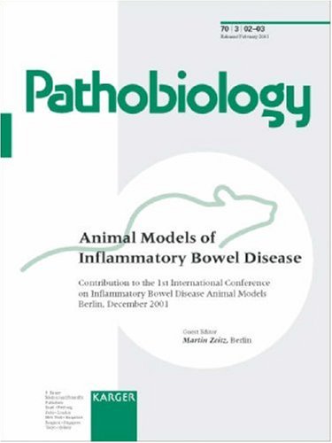 Inflammatory-Bowel-Disease