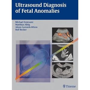 Ultrasound Diagnosis of Fetal Anomalies by Michael Entezami, Matthias Albig, Adam Gasiorek-Wiens, and Rolf Becker