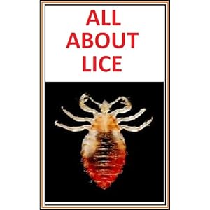 How to get Rid of Lice - All About Lice : Lice Treatment,Detection,Management