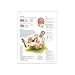 3B Scientific Glossy Paper Stroke Anatomical Chart