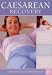 Book Caesarean Recovery