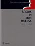 Lasers in Skin Disease