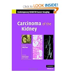 Carcinoma of the Kidney