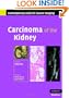 Carcinoma of the Kidney (Contemporary Issues in Cancer Imaging)