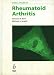 Book Challenges in Rheumatoid Arthritis (Questions & Uncertainties)