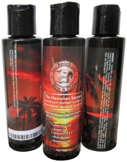 Burn Relief Lotion, Kitchen Burns, Razor Bumps, Insect Bites or Sunburns
