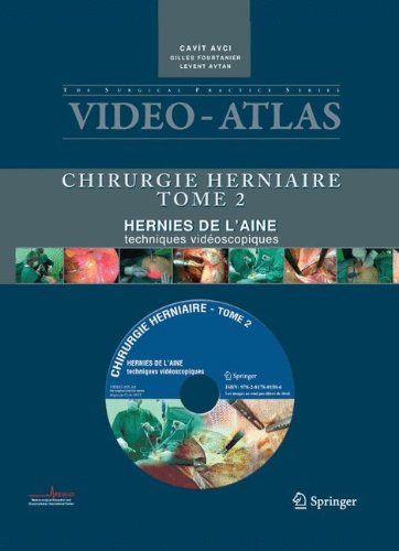 Vid o atlas Chirurgie herniaire: II. Hernie de l'aine, techniques vid oscopiques (Video-Atlas Chirurgie Herniaire) (French Edition)