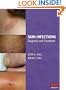Skin Infections: Diagnosis and Treatment