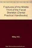 Fractures of the middle third of the facial skeleton