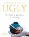 Ugly: The Story of a Loveless Childhood