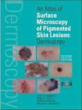 Books : An Atlas of Surface Microscopy of Pigmented Skin Lesions: Dermoscopy,  Second Edition: Dermoscopy