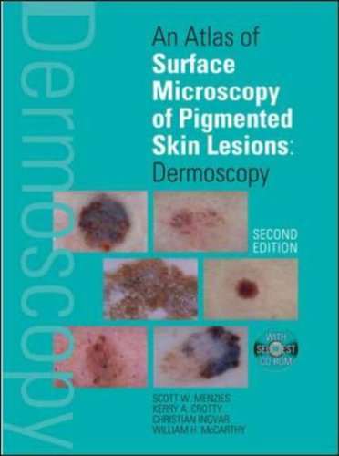 Buy An Atlas of Surface Microscopy of Pigmented Skin Lesions: Dermoscopy,  Second Edition: Dermoscopy online at Discounted New and Used prices. Delivered to your door with Off-The-Bookshelf.
