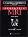 Pediatric MRI (Raven Mri Teaching File)