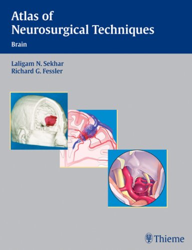 Atlas of Neurosurgical Techniques: Brain