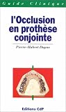 L\'Occlusion en prothèse conjointe