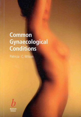 Conditions and Diseases