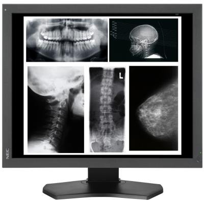 Nec Multisync MD215MG 21.3 Widescreen 5-MEGAPIXEL Medical Diagnostic Display Wit