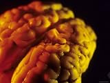 Mammalian Brain Optical Coloring Photographic Poster Print, 24x18
