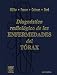 Books : Diagnostico Radiologico de las Enfermedades del Torax