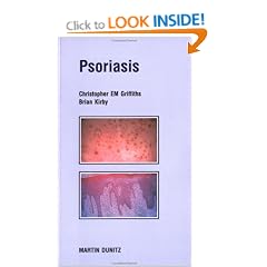 Psoriasis: Pocketbook