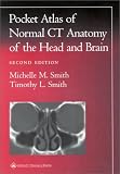A Pocket Atlas of Normal CT Anatomy of the Head and Brain (Radiology Pocket Atlas Series); ISBN: 0781729491; by: <b>Michelle M Smith, Timothy L Smith</b>