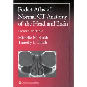 A Pocket Atlas of Normal CT Anatomy of the Head and Brain (Radiology Pocket Atlas Series) by Timothy L Smith