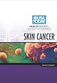 Skin Cancer (USA Today Health Reports: Diseases and Disorders)