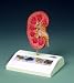 Lippincott Williams + Wilkins Kidney Stone Model Mounted on a base. 5 1/2 inches by 7 inches. Photographs on the base show various types of kidney stones.